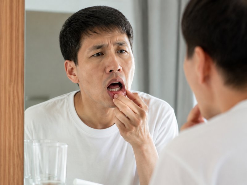 口腔溃疡长时间不愈合会不会是口腔癌的早期症状