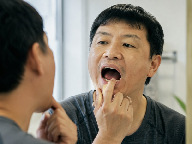 长期吃槟榔会不会导致口腔癌?怎么判断早期症状