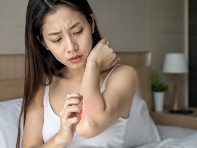 避孕套过敏有什么症状？怎么判断是不是过敏了