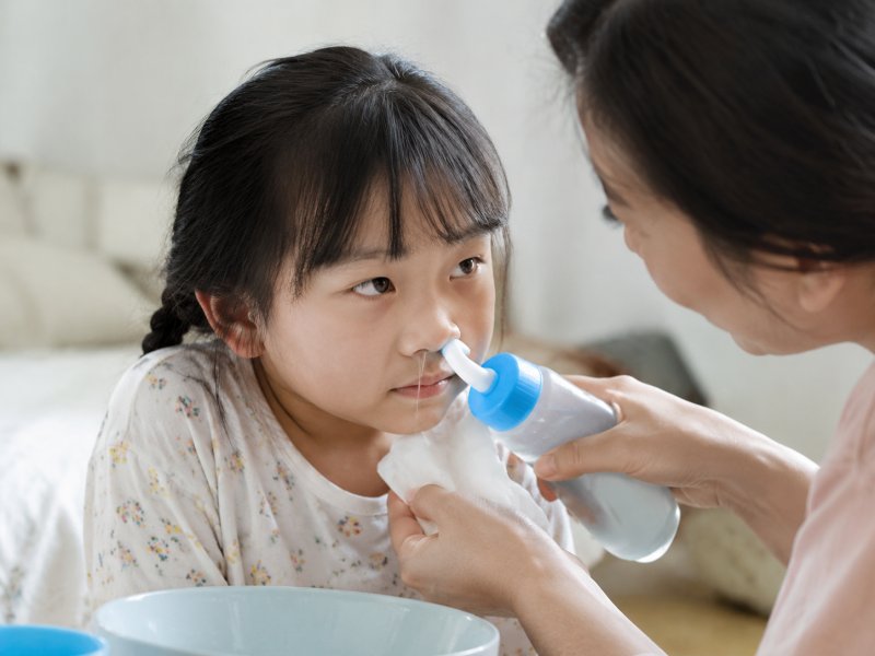 孩子过敏性鼻炎，日常护理上能不能通过洗鼻子来减少发作次数？