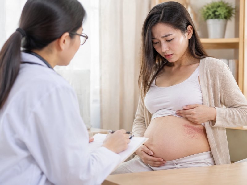 孕妇得了带状疱疹会不会影响胎儿？要不要终止妊娠