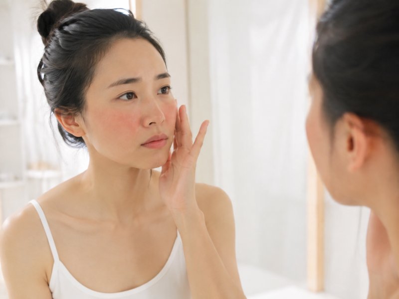 夏天晒后皮肤发红发干怎么办？这3个补水步骤别忽略