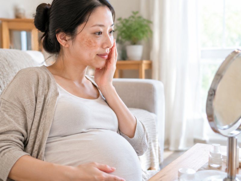 孕期长的黄褐斑生完孩子会不会自己消？要不要提前预防？
