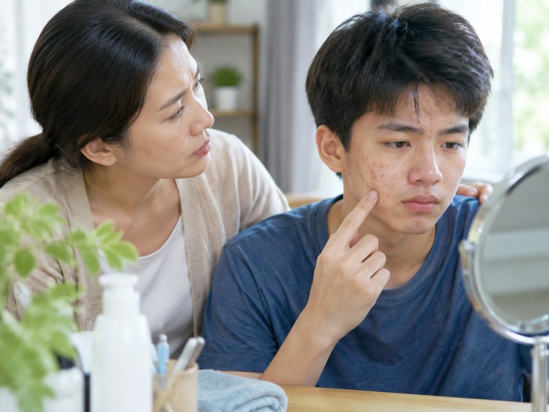 青春期孩子满脸粉刺该如何护理?家长别急着买祛痘产品