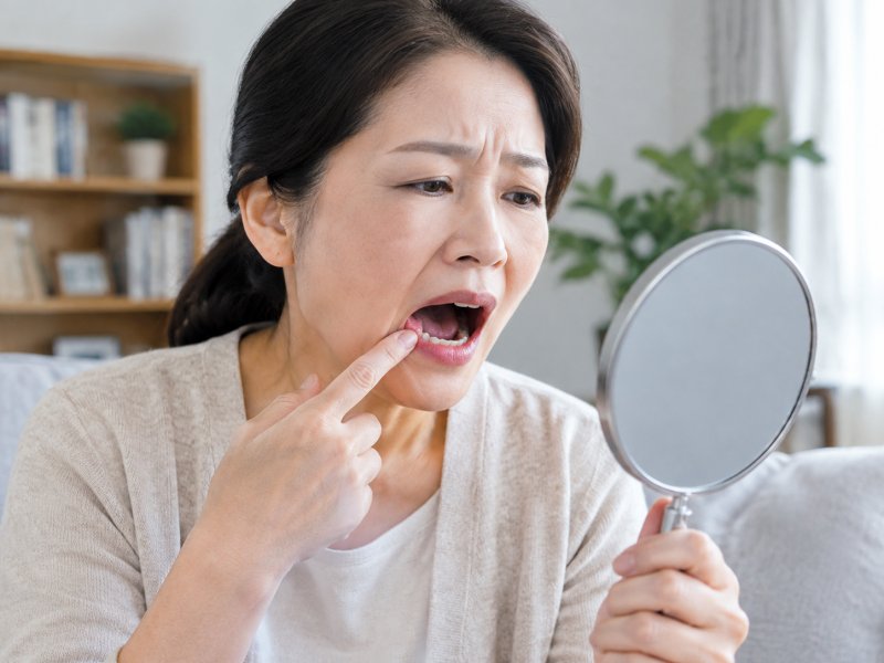 口腔癌早期会有什么信号?出现这些变化要不要赶紧去医院检查