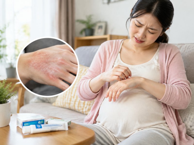 孕妇手足癣发作痒得难受,能不能用外用药膏,怎么选才安全?