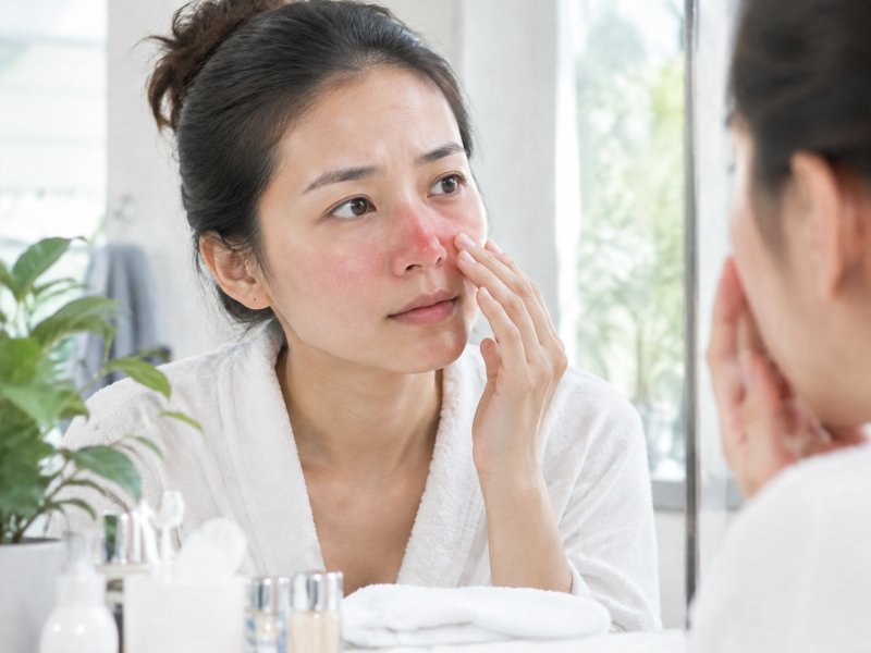 早晚洗脸时鼻子泛红怎么办？酒渣鼻日常护理记住这3个原则