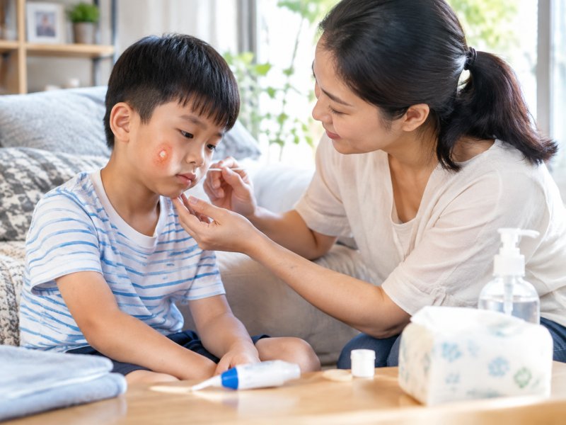 夏天容易长脓疱疮,除了抹西瓜霜,日常怎么预防传染给家人?