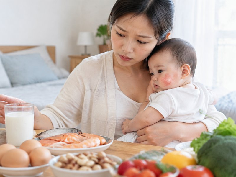 母乳喂养的宝宝长奶癣,妈妈吃什么会加重?日常饮食如何避开过敏原
