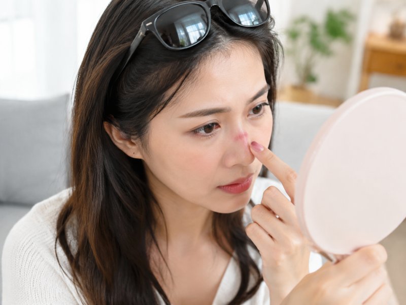墨镜戴久了鼻梁压出红印该怎么护理才能避免脱妆