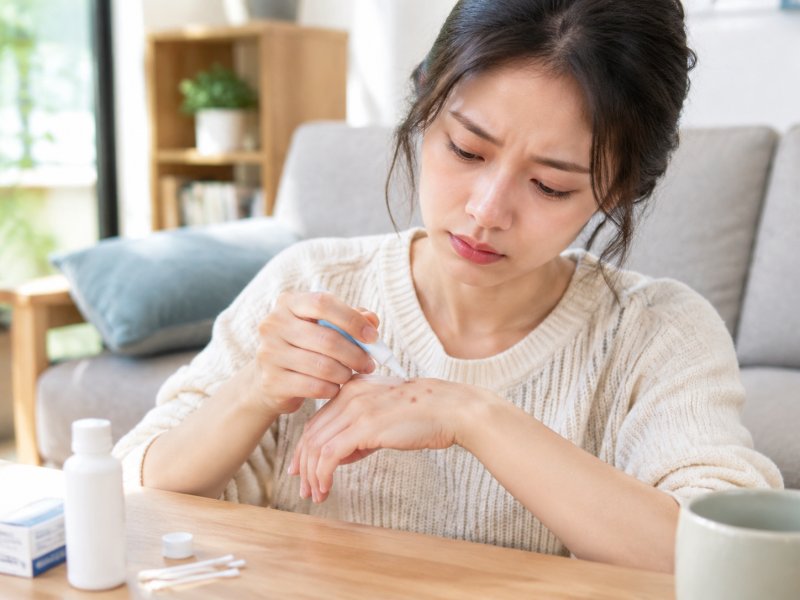 扁平疣抹药多久能看到变化,没变化是不是该换方法?